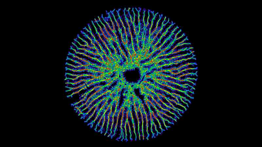 High resolution diatom valve A series of colourful patterns emerge from a single central seed, which is a young diatom valve. These grow outwards and form a halo of branches around the centre